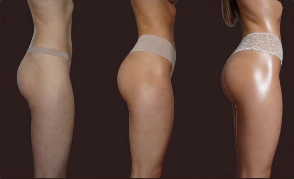 Evolução do programa SKINCODE Corpus em três etapas