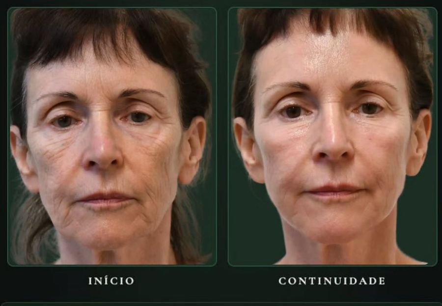 Início e continuidade